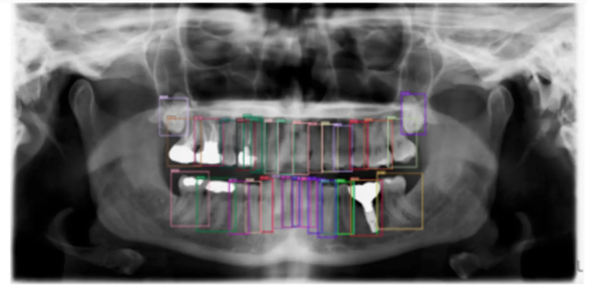 AI teeth